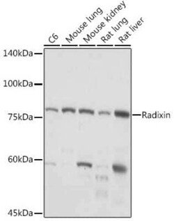 Radixin Rabbit anti-Human, Mouse, Rat, Clone: 4U6W9, Novus Biologicals 100 &mu;g | Buy Online | Novus Biologicals | Fisher Scientific