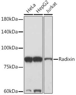 Radixin Rabbit anti-Human, Mouse, Rat, Clone: 4U6W9, Novus Biologicals 100 &mu;g | Buy Online | Novus Biologicals | Fisher Scientific