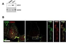 Radixin Antibody (1E12), Novus Biologicals 0.05 mg | Buy Online | Novus Biologicals | Fisher Scientific