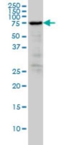 Novus Biologicals Radixin Antibody (1F6), Novus Biologicals 0.1 mg | Buy Online | Novus Biologicals&trade; | Fisher Scientific