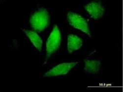 Raf-1 Antibody, Novus Biologicals 0.05 mg | Buy Online | Novus Biologicals | Fisher Scientific