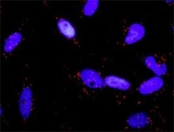 RalA/RalB Antibody (3E6), Novus Biologicals 0.1 mg | Buy Online | Novus Biologicals | Fisher Scientific