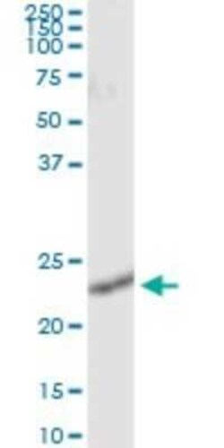 RalB Antibody (4D1), Novus Biologicals 0.1 mg | Buy Online | Novus Biologicals | Fisher Scientific