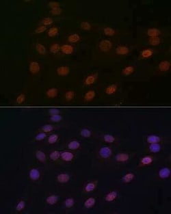 RanGAP1 Rabbit anti-Human, Mouse, Rat, Clone: 1E7R7, Novus Biologicals 20 &mu;g | Buy Online | Bio-Techne | Fisher Scientific