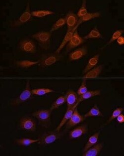 RanGAP1 Rabbit anti-Human, Mouse, Rat, Clone: 1E7R7, Novus Biologicals 20 &mu;g | Buy Online | Bio-Techne | Fisher Scientific