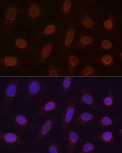 RanGAP1 Rabbit anti-Human, Mouse, Rat, Clone: 1E7R7, Novus Biologicals 20 &mu;g | Buy Online | Bio-Techne | Fisher Scientific