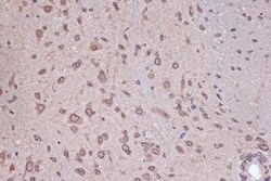 RanGAP1 Rabbit anti-Human, Mouse, Rat, Clone: 1E7R7, Novus Biologicals 20 &mu;g | Buy Online | Bio-Techne | Fisher Scientific