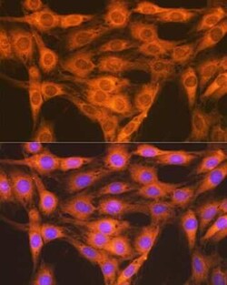 Rap1A/B Rabbit anti-Human, Mouse, Rat, Clone: 6C7G0, Novus Biologicals 100 &mu;g | Buy Online | Novus Biologicals | Fisher Scientific