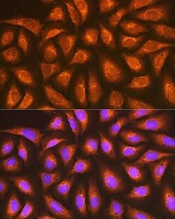 Rap1A/B Rabbit anti-Human, Mouse, Rat, Clone: 6C7G0, Novus Biologicals 100 &mu;g | Buy Online | Novus Biologicals | Fisher Scientific