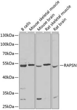 Rapsyn Antibody - BSA Free, Novus Biologicals 0.1 mL; Unconjugated:Antibodies,