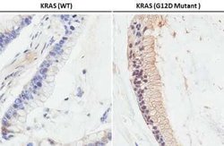 Ras Antibody (HL10) - G12D Mutant, Novus Biologicals 100 &mu;g | Buy Online | Novus Biologicals | Fisher Scientific