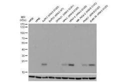 Ras Antibody (HL10) - G12D Mutant, Novus Biologicals 100 &mu;g | Buy Online | Novus Biologicals | Fisher Scientific