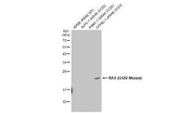 Ras Antibody (HL169) - G12V Mutant, Novus Biologicals 100 &mu;g | Buy Online | Novus Biologicals | Fisher Scientific