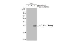 Ras Antibody - G12D Mutant, Novus Biologicals 100 &mu;g | Buy Online | Bio-Techne | Fisher Scientific
