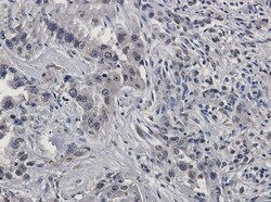 Ras-GAP Antibody (S01-1D7), Novus Biologicals:Anticuerpos:Anticuerpos primarios