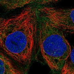 Rasgrp1 Antibody, Novus Biologicals 25ul; Unconjugated:Antibodies, Polyclonal