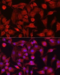 Rasgrp1 Antibody - BSA Free, Novus Biologicals:Antibodies:Primary Antibodies