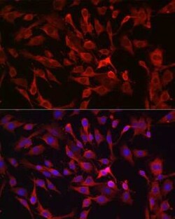 Rasgrp1 Antibody - BSA Free, Novus Biologicals:Antibodies:Primary Antibodies
