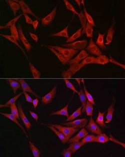 Rasgrp1 Antibody - BSA Free, Novus Biologicals:Antibodies:Primary Antibodies