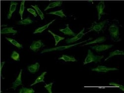 Recoverin Antibody (3F6), Novus Biologicals 0.1 mg, Unconjugated:Anticuerpos