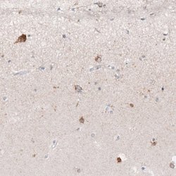 Reelin Antibody (CL5324), Novus Biologicals:Antibodies:Primary Antibodies