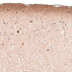 Reelin Antibody (CL5324), Novus Biologicals:Antibodies:Primary Antibodies