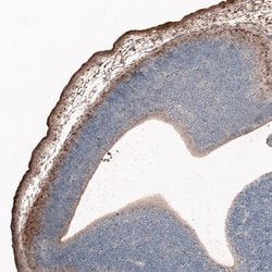 Reelin Antibody (CL5324), Novus Biologicals:Antibodies:Primary Antibodies