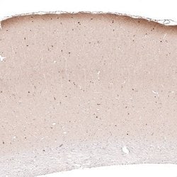 Reelin Antibody (CL5324), Novus Biologicals:Antibodies:Primary Antibodies