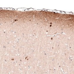 Reelin Antibody (CL5324), Novus Biologicals:Antibodies:Primary Antibodies