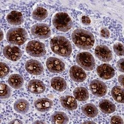 Reg1A Antibody, Novus Biologicals 0.1 mL; Unconjugated:Antibodies, Polyclonal