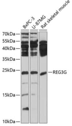 Reg3G Antibody - BSA Free, Novus Biologicals:Antibodies:Primary Antibodies