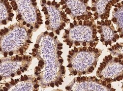 Reg4 Rabbit anti-Human, Clone: 244, Novus Biologicals 100 &mu;g; Unconjugated:Antibodies,