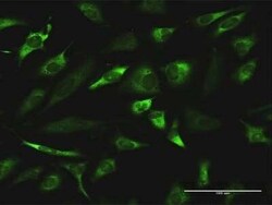 Regucalcin Antibody (4B9), Novus Biologicals 0.1 mg | Buy Online | Novus Biologicals | Fisher Scientific