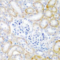 Relaxin-2 Antibody - BSA Free, Novus Biologicals:Antibodies:Primary Antibodies