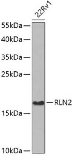 Relaxin-2 Antibody - BSA Free, Novus Biologicals:Antibodies:Primary Antibodies