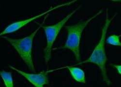 Renin Rabbit anti-Human, Clone: 9, Novus Biologicals 100 &mu;g; Unconjugated:Antibodies,