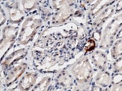 Renin Rabbit anti-Human, Clone: 9, Novus Biologicals 100 &mu;g; Unconjugated:Antibodies,