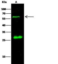 Renin Rabbit anti-Human, Clone: 9, Novus Biologicals 100 &mu;g; Unconjugated:Antibodies,