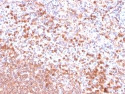 Resistin Mouse anti-Human, Clone: RETN/4326, Novus Biologicals 20 &mu;g;