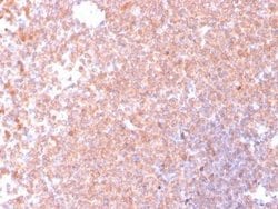 Resistin Mouse anti-Human, Clone: RETN/4326, Novus Biologicals 20 &mu;g;