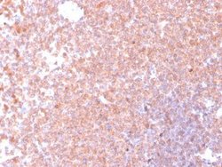 Resistin Antibody (RETN/4326) - Azide and BSA Free, Novus Biologicals 100 &mu;g | Buy Online | Novus Biologicals | Fisher Scientific