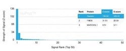 Resistin Mouse anti-Human, Clone: RETN/4326, Novus Biologicals 20 &mu;g;