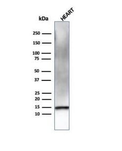 Resistin Mouse anti-Human, Clone: RETN/4326, Novus Biologicals 20 &mu;g;