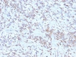 Retinol Binding Protein RBP Mouse anti-Human, Mouse, Rat, Goat, Chimpanzee,