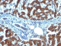 Retinol Binding Protein RBP Antibody (RBP/872), Novus Biologicals:Antibodies:Primary