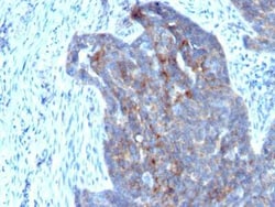 Retinol Binding Protein RBP Antibody (RBP/872), Novus Biologicals:Antibodies:Primary