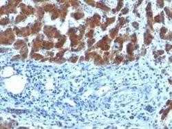 Retinol Binding Protein RBP Antibody (SPM442), Novus Biologicals 0.02 mg;