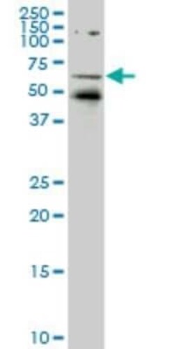Rev-erb A alpha/NR1D1 Antibody (5H6), Novus Biologicals 0.1 mg | Buy Online | Novus Biologicals | Fisher Scientific