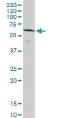 Rev-erb beta/NR1D2 Antibody, Novus Biologicals 0.1 mg, Unconjugated:Antibodies,