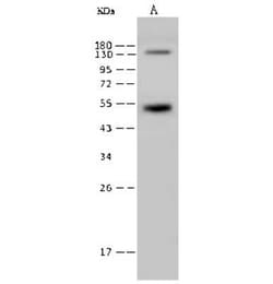 Rex-1/ZFP42 Antibody, Novus Biologicals 50 &mu;g; Unconjugated:Antibodies,